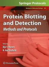 Protein Blotting and Detection: Methods and Protocols