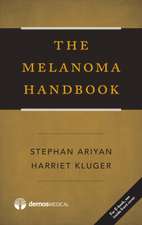 The Melanoma Handbook