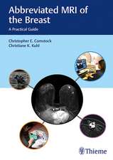 Abbreviated MRI of the Breast – A Practical Guide