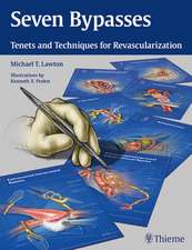 Seven Bypasses – Tenets and Techniques for Revascularization