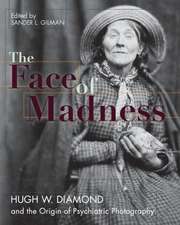 Face of Madness: Hugh W. Diamond and the Origin of Psychiatric Photography