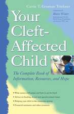 Your Cleft-Affected Child: The Complete Book of Information, Resources, and Hope