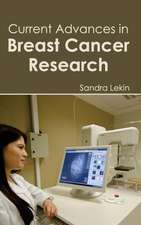 Current Advances in Breast Cancer Research