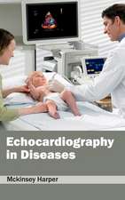 Echocardiography in Diseases