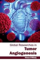 Global Researches in Tumor Angiogenesis