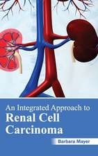 Integrated Approach to Renal Cell Carcinoma: History, Mechanism and Advances