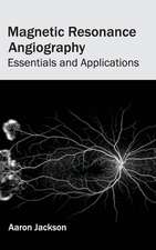 Magnetic Resonance Angiography