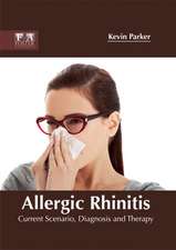 Allergic Rhinitis
