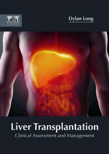 Liver Transplantation