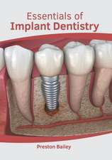 Essentials of Implant Dentistry