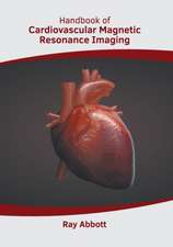 Handbook of Cardiovascular Magnetic Resonance Imaging