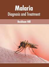 Malaria: Diagnosis and Treatment