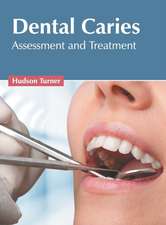 Dental Caries: Assessment and Treatment