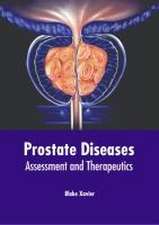 Prostate Diseases: Assessment and Therapeutics