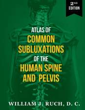 Atlas of Common Subluxations of the Human Spine and Pelvis, Second Edition