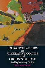 Causative Factors of Ulcerative Colitis and Crohn's Disease: An Exploratory Guide