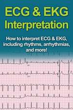 ECG & EKG Interpretation