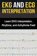 EKG and ECG Interpretation