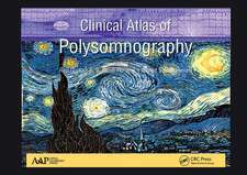 Clinical Atlas of Polysomnography