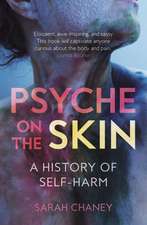 Psyche on the Skin: A History of Self-Harm