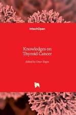 Knowledges on Thyroid Cancer