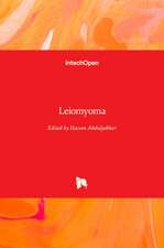Leiomyoma