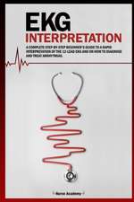 Ekg Interpretation