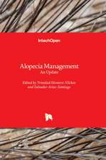 Alopecia Management - An Update