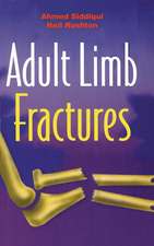 Adult Limb Fractures