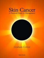 Skin Cancer