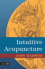 Intuitive Acupuncture