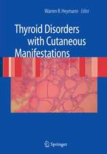 Thyroid Disorders with Cutaneous Manifestations