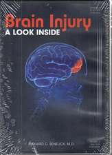 Brain Injury DVD: A Look Inside