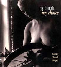 My Breasts, My Choice