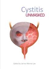 Cystitis Unmasked