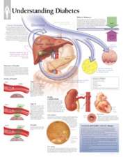 Understanding Diabetes