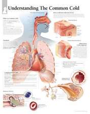 The Common Cold Chart: Laminated Wall Chart