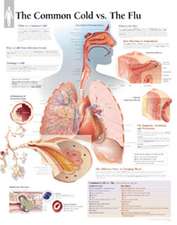 The Common Cold Vs Flu Chart: Wall Chart