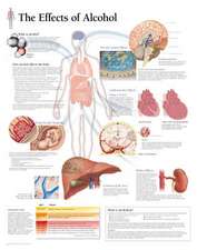 The Effects of Alcohol Chart: Wall Chart