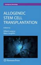 Allogeneic Stem Cell Transplantation