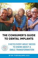 The Consumer's Guide to Dental Implants