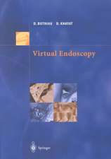 Virtual Endoscopy