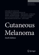 Cutaneous Melanoma