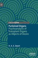 Purloined Organs: Psychoanalysis of Transplant Organs as Objects of Desire