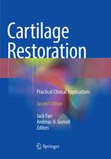 Cartilage Restoration: Practical Clinical Applications