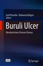 Buruli Ulcer: Mycobacterium Ulcerans Disease