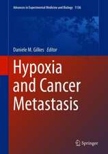 Hypoxia and Cancer Metastasis