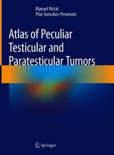 Atlas of Peculiar and Common Testicular and Paratesticular Tumors