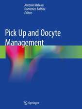 Pick Up and Oocyte Management