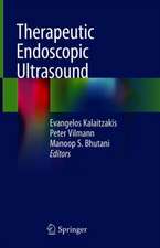 Therapeutic Endoscopic Ultrasound